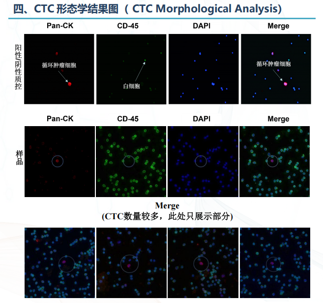 MRD检测-1.png MRD检测-1.png