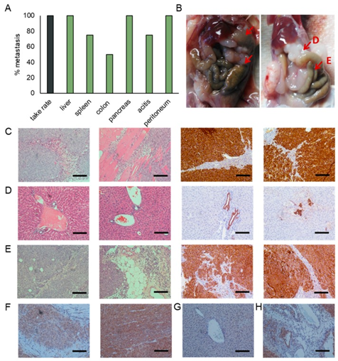 CTC细胞株与PDX模型构建-2.png CTC细胞株与PDX模型构建-2.png