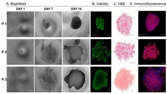 CTC细胞株与PDX模型构建.png CTC细胞株与PDX模型构建.png